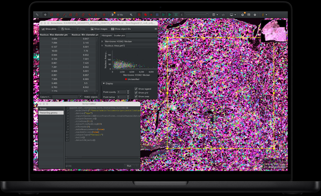 Scherm van MacBook Pro met QuPath en Instanseg